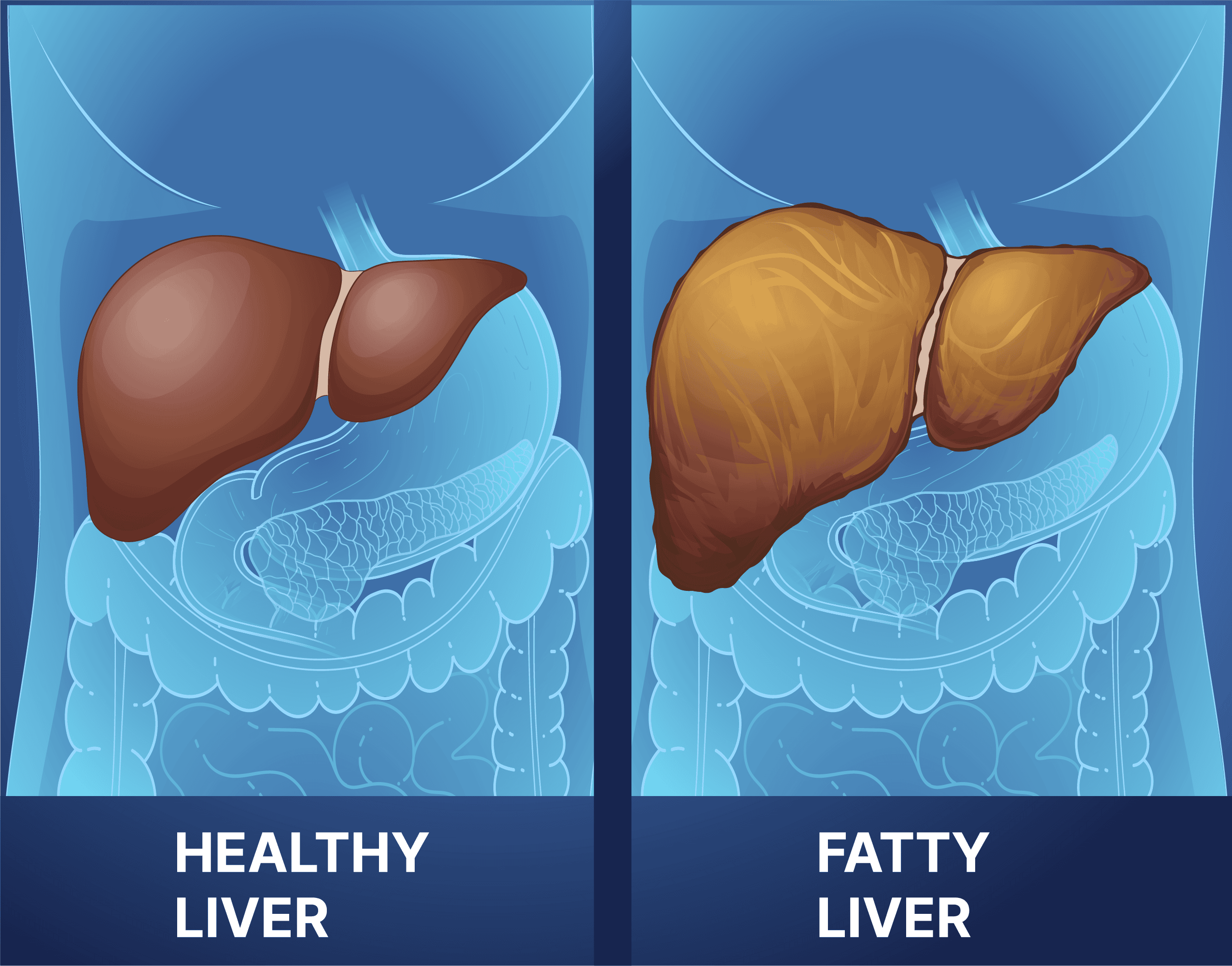 liver 2